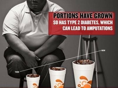 Why Tackling Obesity NOW Is A Smart Strategy For Coke