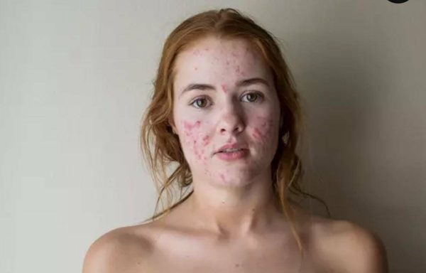 Is the Body Positive Movement Really A Good Thing?